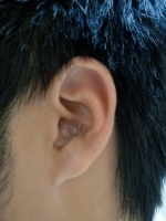 耳つぼ